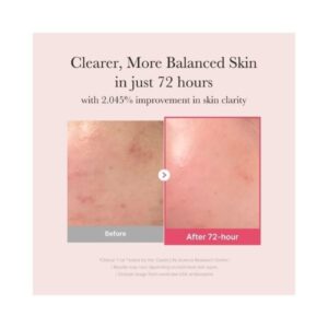 Medicube TXA Niacinamide 15% Serum 30mL